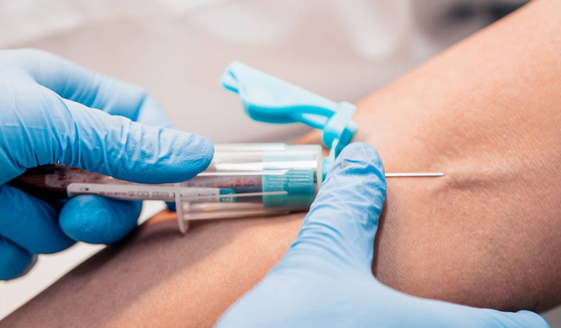 تزریق آمپول و سرم در منزل در غرب استانبول