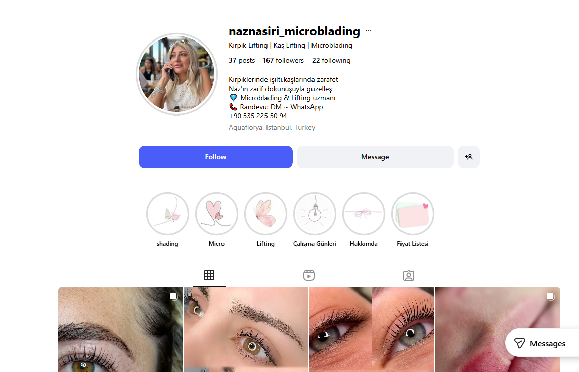 شید لب، لیفت و میکروبلیدینگِ ناز نصیری