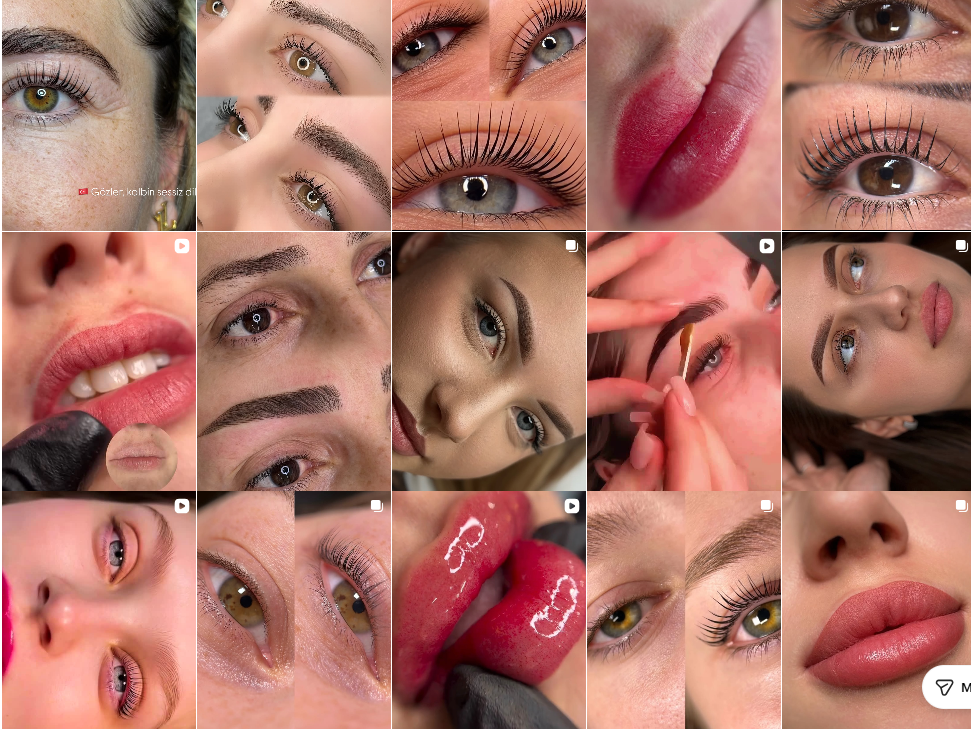 شید لب، لیفت و میکروبلیدینگِ ناز نصیری